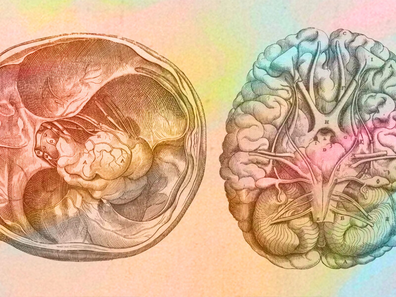 Thackray Insights: What Colour is a Brain?